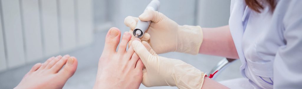 Schimmelnagelspecialist | effectief verzorgen van kalknagels en schimmelnagels